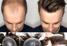 Hair Pieces for Men