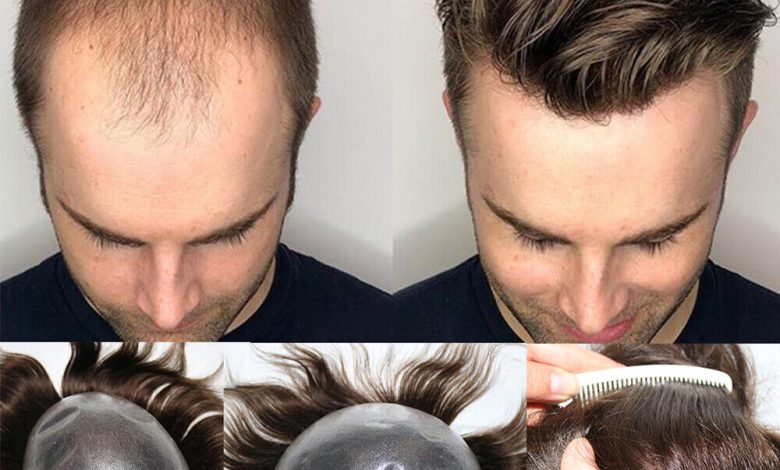 Hair Pieces for Men