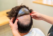 men's hair pieces