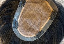 Best Mens hair systems