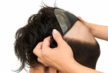 Mens Hair Systems